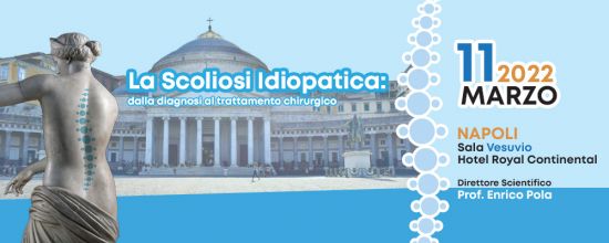 La Scoliosi Idiopatica: dalla diagnosi al trattamento chirurgico La Scoliosi Idiopatica: dalla diagnosi al trattamento chirurgico